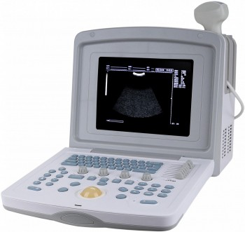 УЗИ сканер Med-Mos CMS600B3 Код товара: 00793